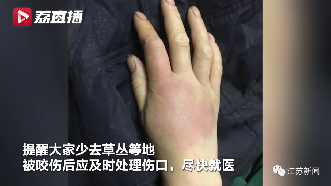 新澳今晚特9点30开什么和女子遭毒蛇咬伤身亡与女子遭毒蛇咬伤身亡视频