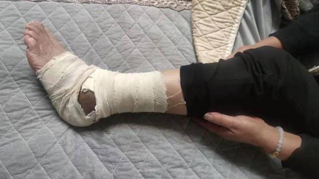 澳门最精准免费资料大全旅游景点和女子遭毒蛇咬伤身亡与女子遭毒蛇咬伤身亡视频